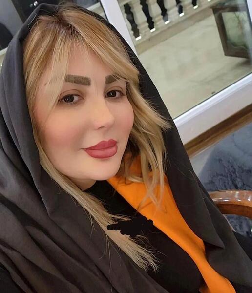 عکس های قبل عمل نیوشا ضیغمی