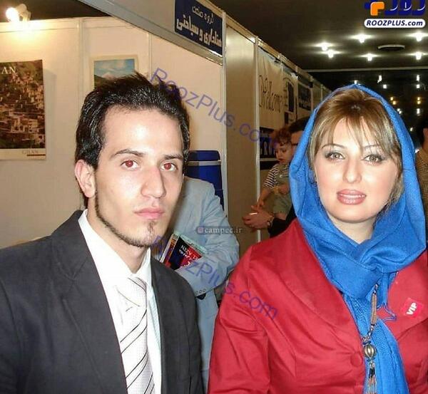عکس های قبل عمل نیوشا ضیغمی