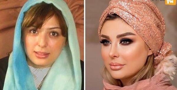 عکس های قبل عمل نیوشا ضیغمی
