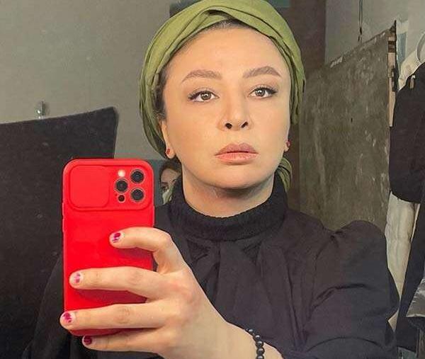 عکس مه لقا جابری قبل از عمل زیبایی