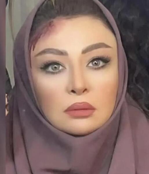 عکس مه لقا جابری قبل از عمل زیبایی