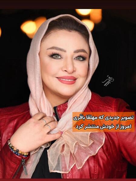 عکس مه لقا جابری قبل از عمل زیبایی