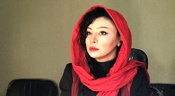 عکس مه لقا جابری قبل از عمل زیبایی