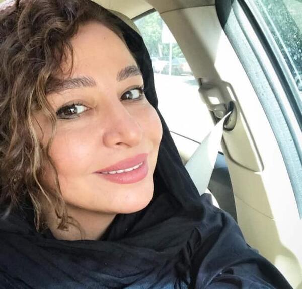 عکس مه لقا جابری قبل از عمل زیبایی