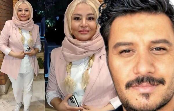 عکس مه لقا جابری قبل از عمل زیبایی