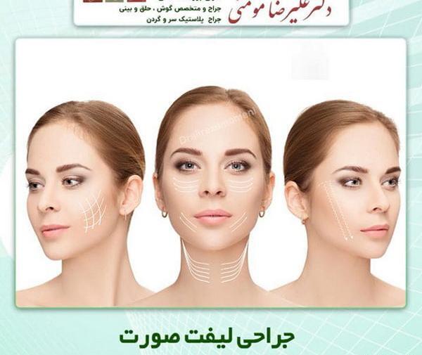عکس قبل و بعد جراحی لیفت صورت