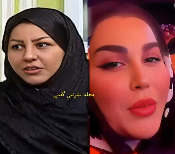 عکس قبل عمل طاها بهمنی