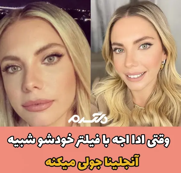 عکس های قبل عمل آنجلینا جولی