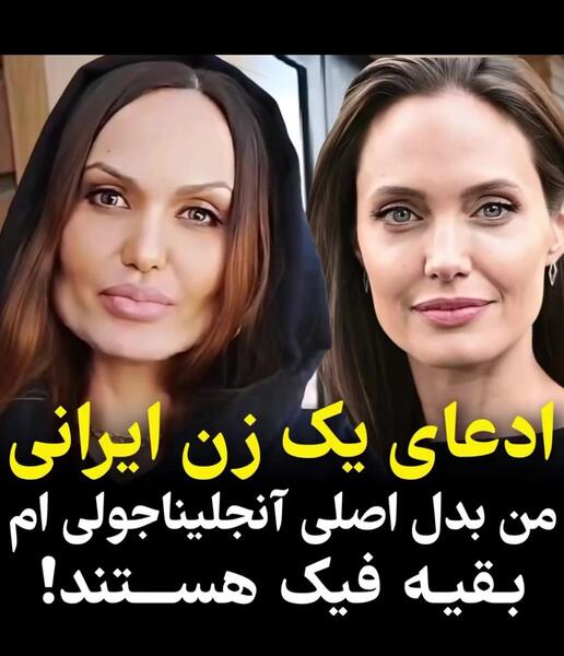 عکس های قبل عمل آنجلینا جولی