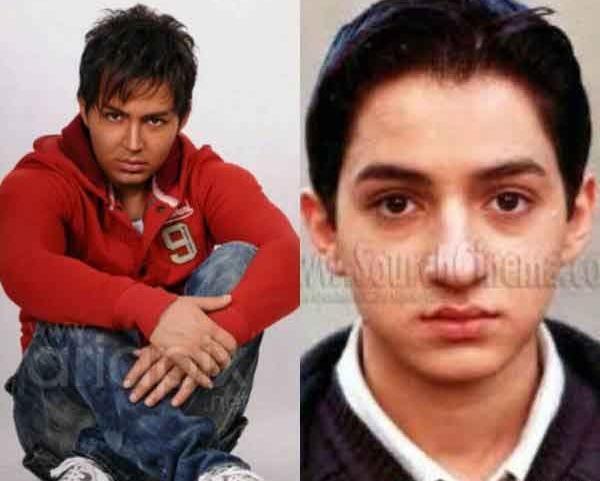 عکس قبل از عمل دماغ محسن یگانه
