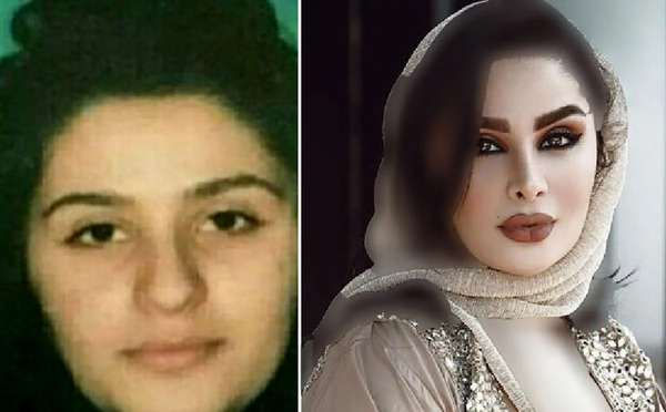 عکس دنیا جهانبخت در ایران قبل از عمل