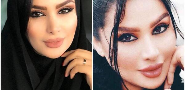 عکس دنیا جهانبخت در ایران قبل از عمل
