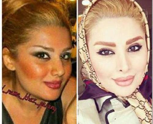 عکس دنیا جهانبخت در ایران قبل از عمل