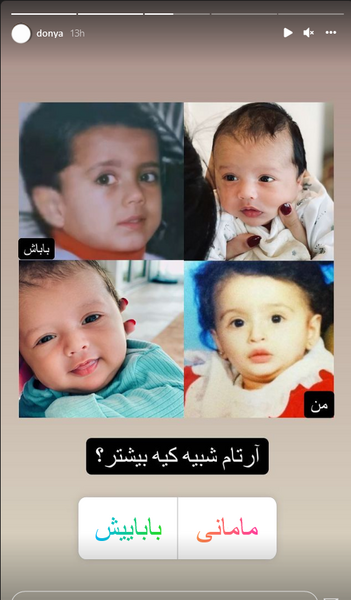 عکس دنیا جهانبخت در ایران قبل از عمل
