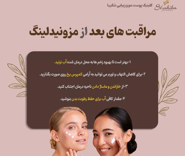 عکس قبل و بعد مزونیدلینگ مو