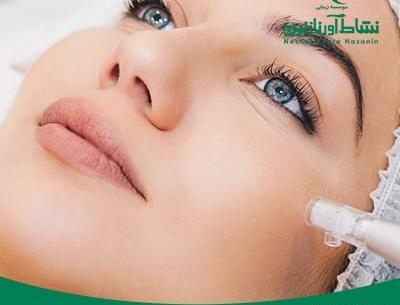 عکس قبل و بعد مزونیدلینگ مو