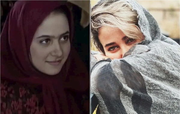 عکس قبل از عمل بینی الناز حبیبی