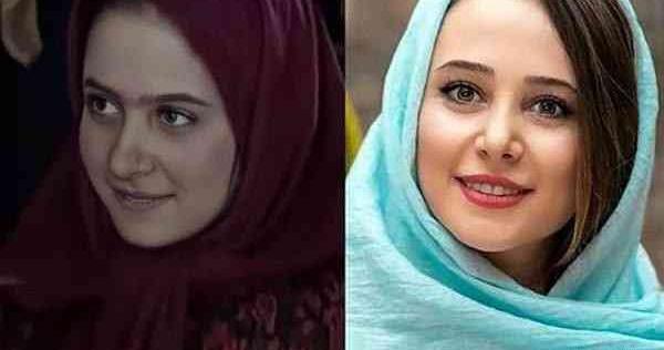 عکس قبل از عمل بینی الناز حبیبی
