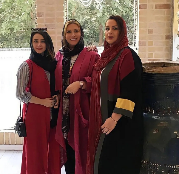 عکس قبل از عمل بینی الناز حبیبی