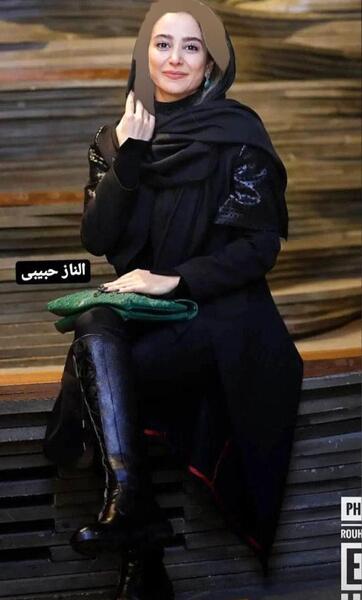 عکس قبل از عمل بینی الناز حبیبی
