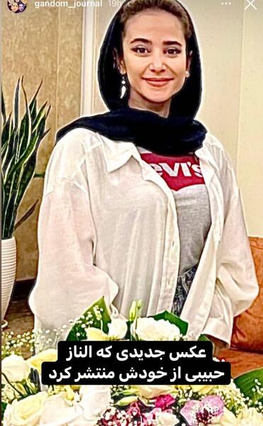 عکس قبل از عمل بینی الناز حبیبی