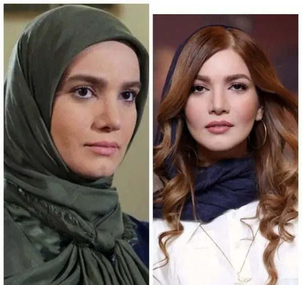 عکس قبل از عمل بینی الناز حبیبی