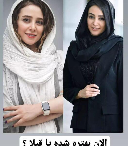 عکس قبل از عمل بینی الناز حبیبی