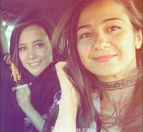 عکس های قبل از عمل الناز حبیبی