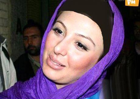 عکس های قبل از عمل الناز حبیبی