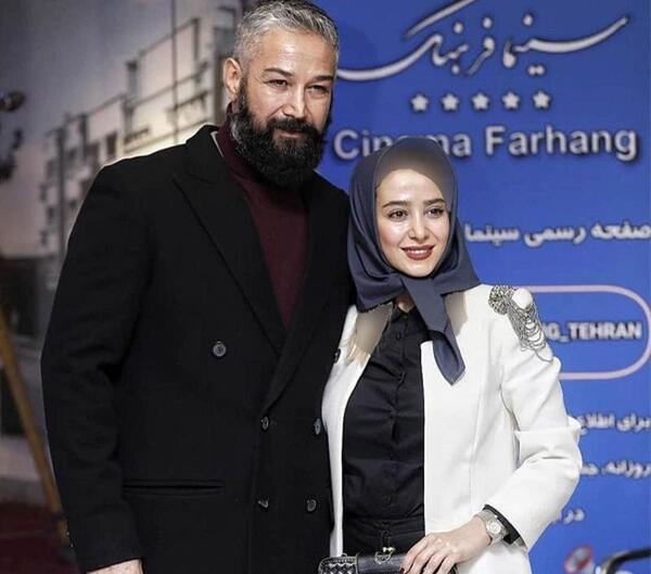 عکس های قبل از عمل الناز حبیبی