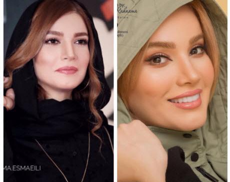 عکس قبل بعد متین ستوده