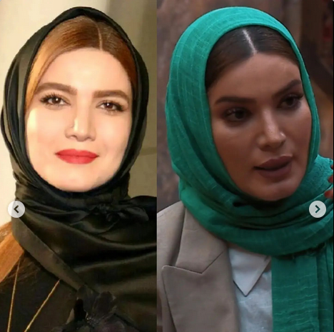 عکس قبل بعد متین ستوده