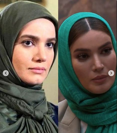 عکس قبل بعد متین ستوده