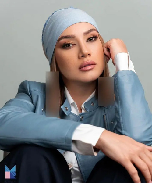 عکس قبل بعد متین ستوده