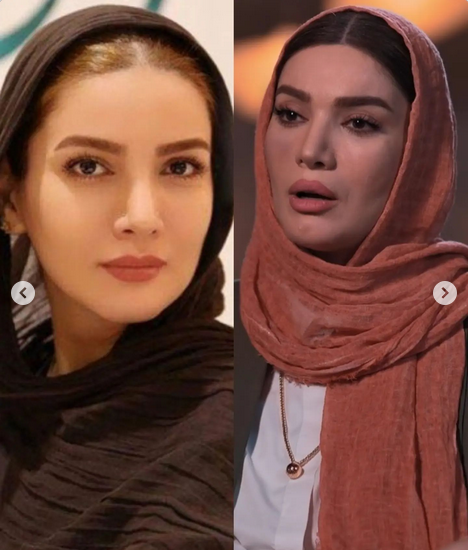 عکس قبل بعد متین ستوده