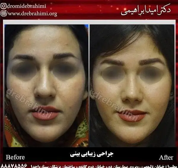 عکس قبل و بعد ارایش زنان