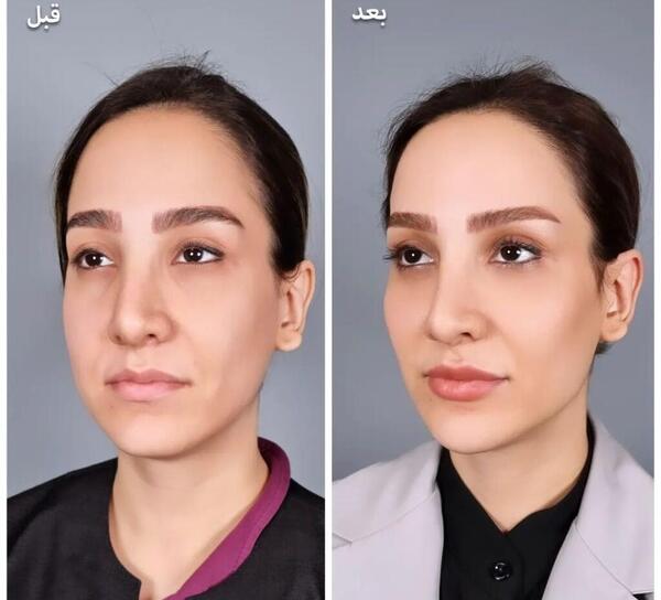 عکس قبل و بعد از آرایش