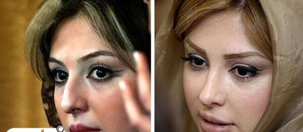 عکس های قبل عمل نیکا