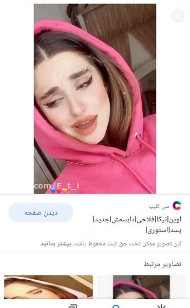عکس های قبل عمل نیکا