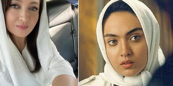 عکس های قبل عمل نیکا