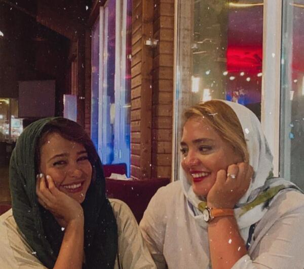 عکس های الناز حبیبی قبل از عمل بینی