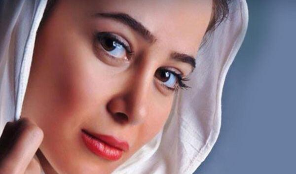 عکس های الناز حبیبی قبل از عمل بینی