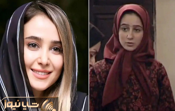عکس های الناز حبیبی قبل از عمل بینی
