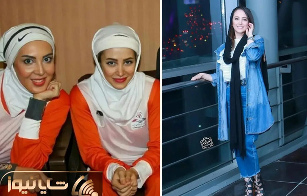 عکس های الناز حبیبی قبل از عمل بینی