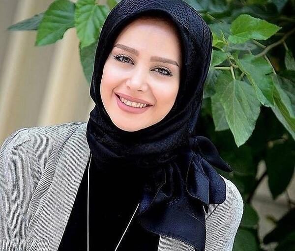 عکس های الناز حبیبی قبل از عمل بینی