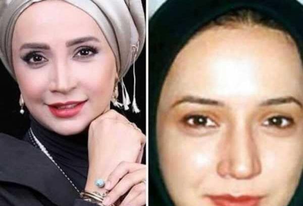 عکس های الناز حبیبی قبل از عمل بینی