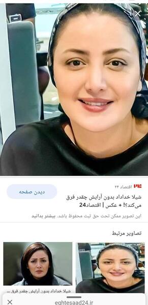 عکس های الناز حبیبی قبل از عمل بینی