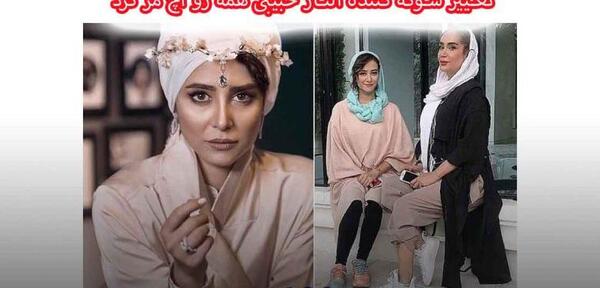 عکس های الناز حبیبی قبل از عمل بینی