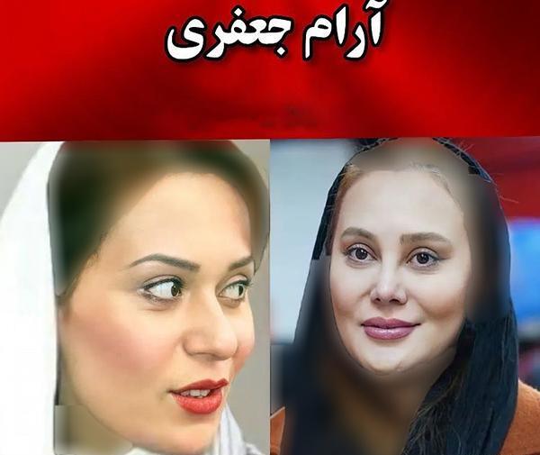 عکس های الناز حبیبی قبل از عمل بینی