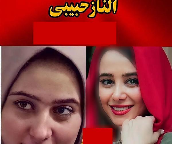 عکس های الناز حبیبی قبل از عمل بینی